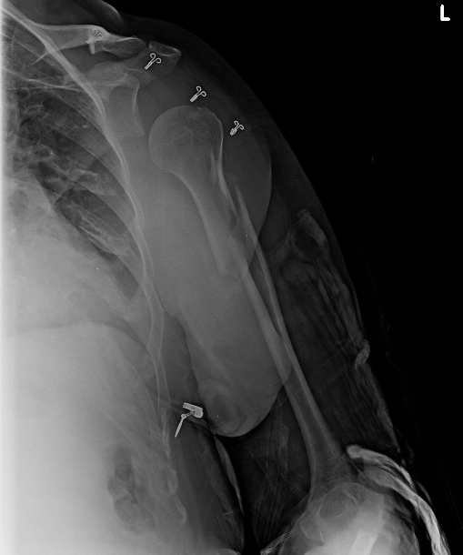 Screen Shot 2017-10-06 at 11.58.31 PM