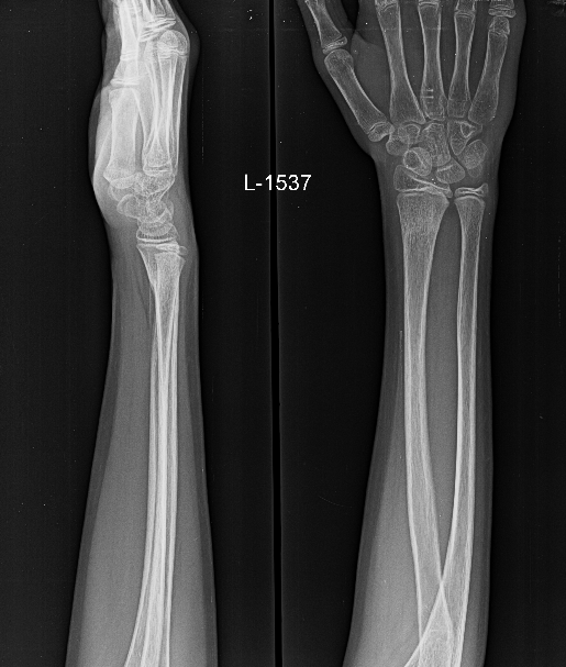 Screen Shot 2017-10-06 at 11.59.35 PM