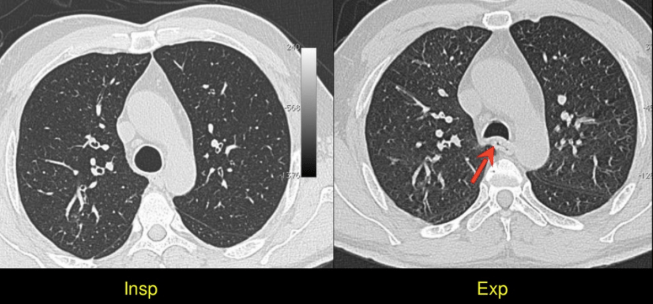 Screen Shot 2017-12-03 at 12.14.35 AM